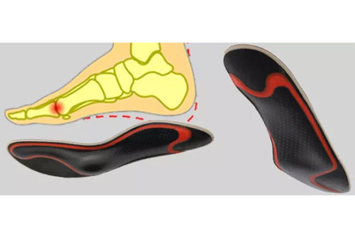 Mediroyal%20Hallux%20Carbon2